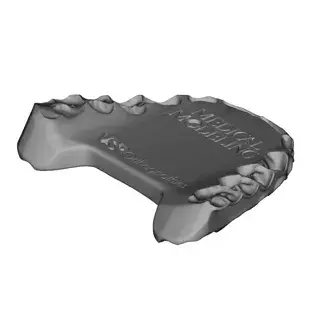 Splint Design 1