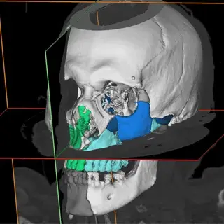 Augmented DICOM