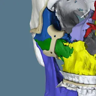 Surgical Guides