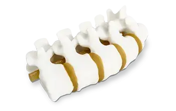 3D Systems 的 3D 打印脊柱解剖模型