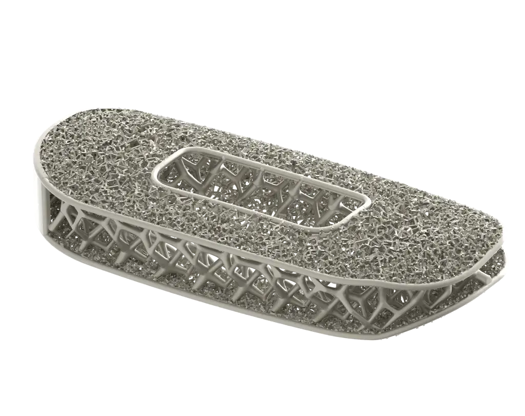 NuVasive 采用 3D 打印技术生产的优化脊椎植入体