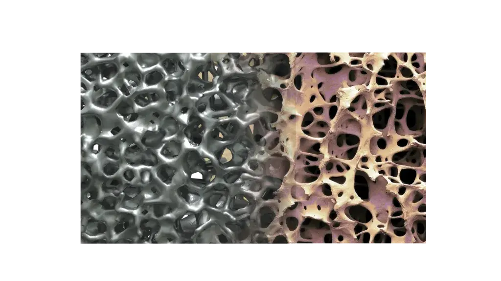 NuVasive 的 Modulus 系列脊椎植入体的设计旨在改善脊椎植入体患者的临床效果。