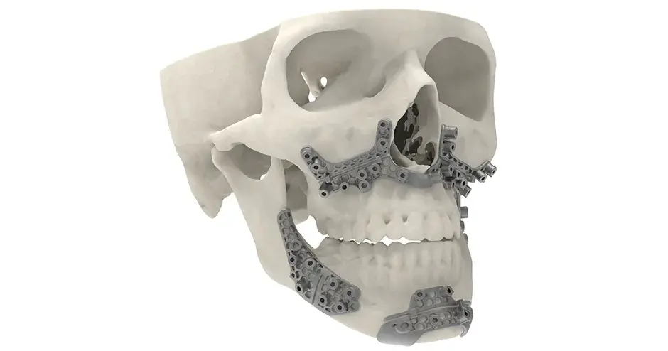 a CMF model