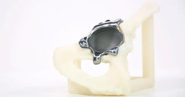 3d-systems-healthcare-ossis-tri-flange