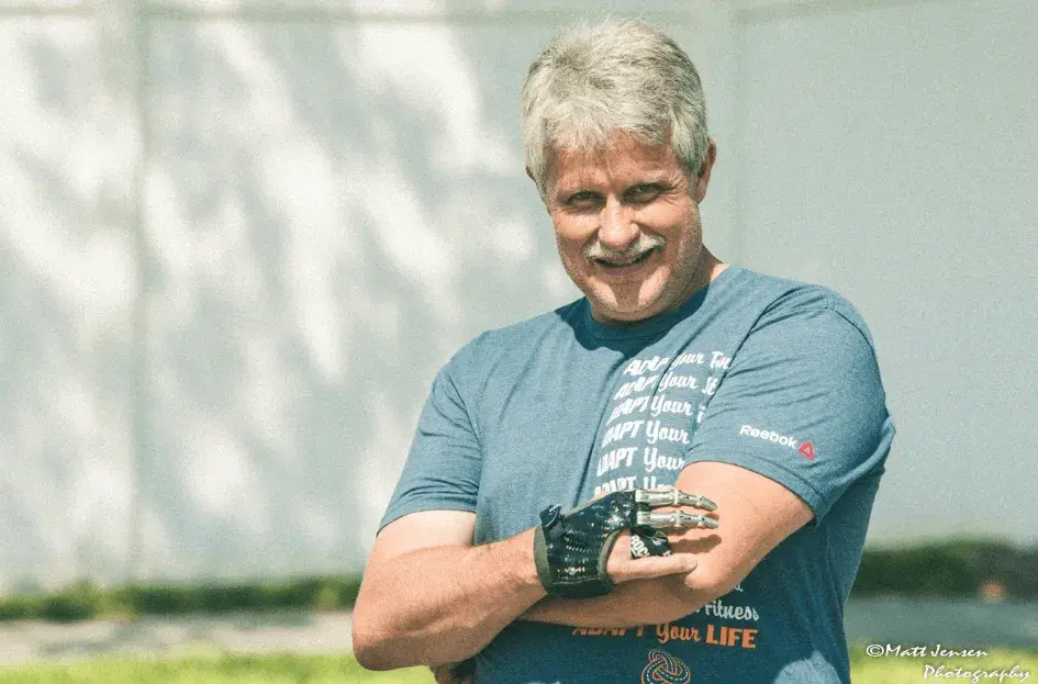 Jeff Soelberg 戴着由 Point Designs 设计的手部假肢