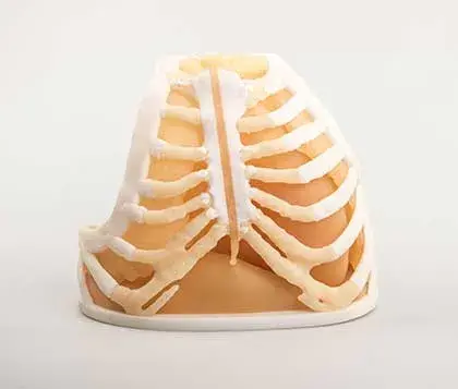 3d printed ribcage encapsulating tissue and organs