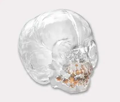 Clear 3d printed skull