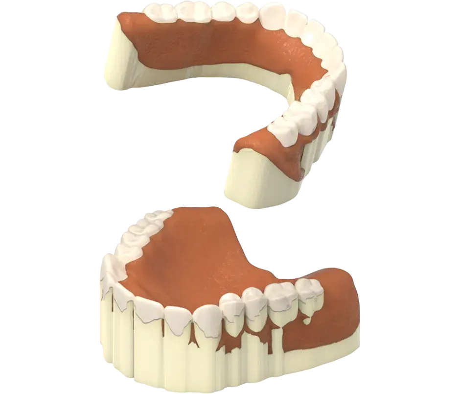 NextDent 生产移除支持