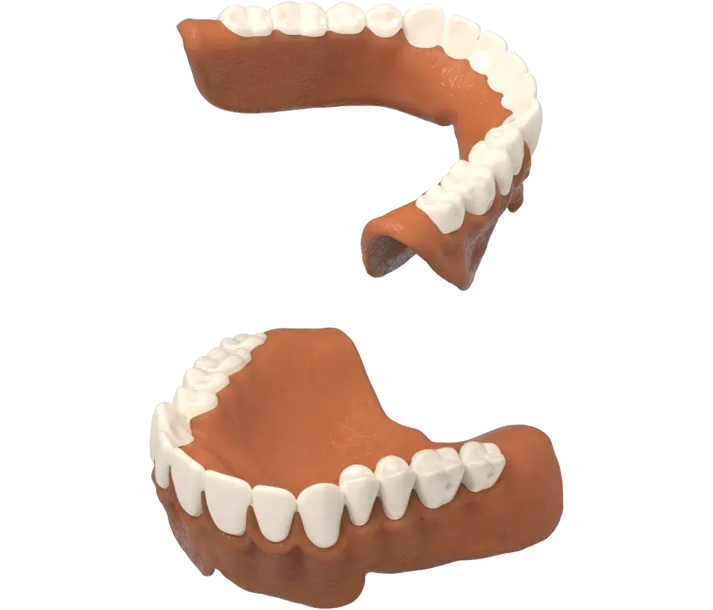 NextDent 生产蜡已被移除