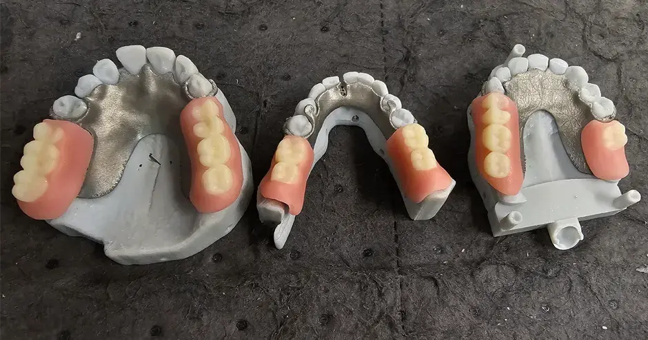 3D 打印义齿