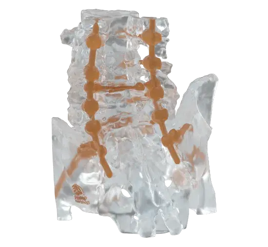 Anatomic model made from Accura ClearVue