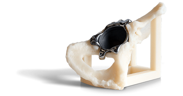 SLA 骨骼模型上的钛三侧凸缘髋关节杯