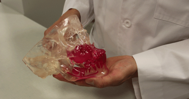 Surgeon holding an SLA anatomical model for pre-surgical planning