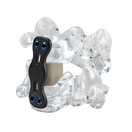 3D printed spinal cage device in PEEK for spinal surgeries 