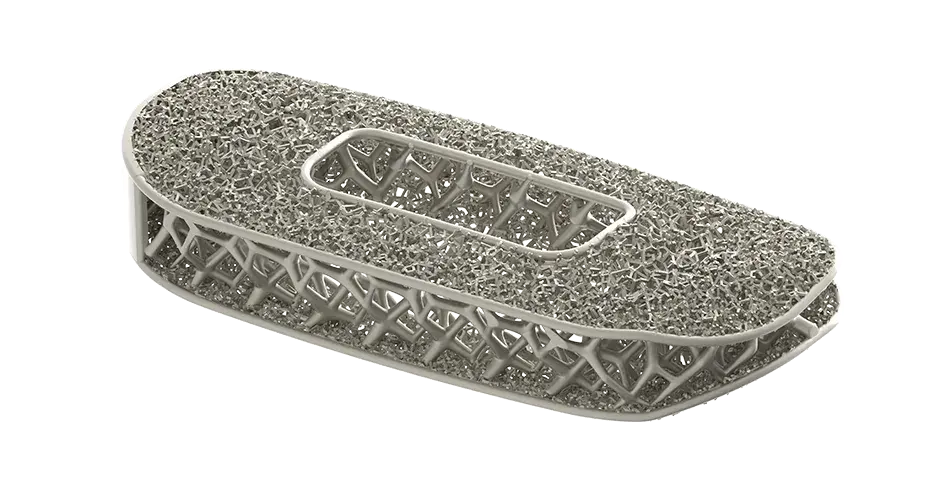 NuVasive 采用 3D 打印技术生产的优化脊椎植入体 